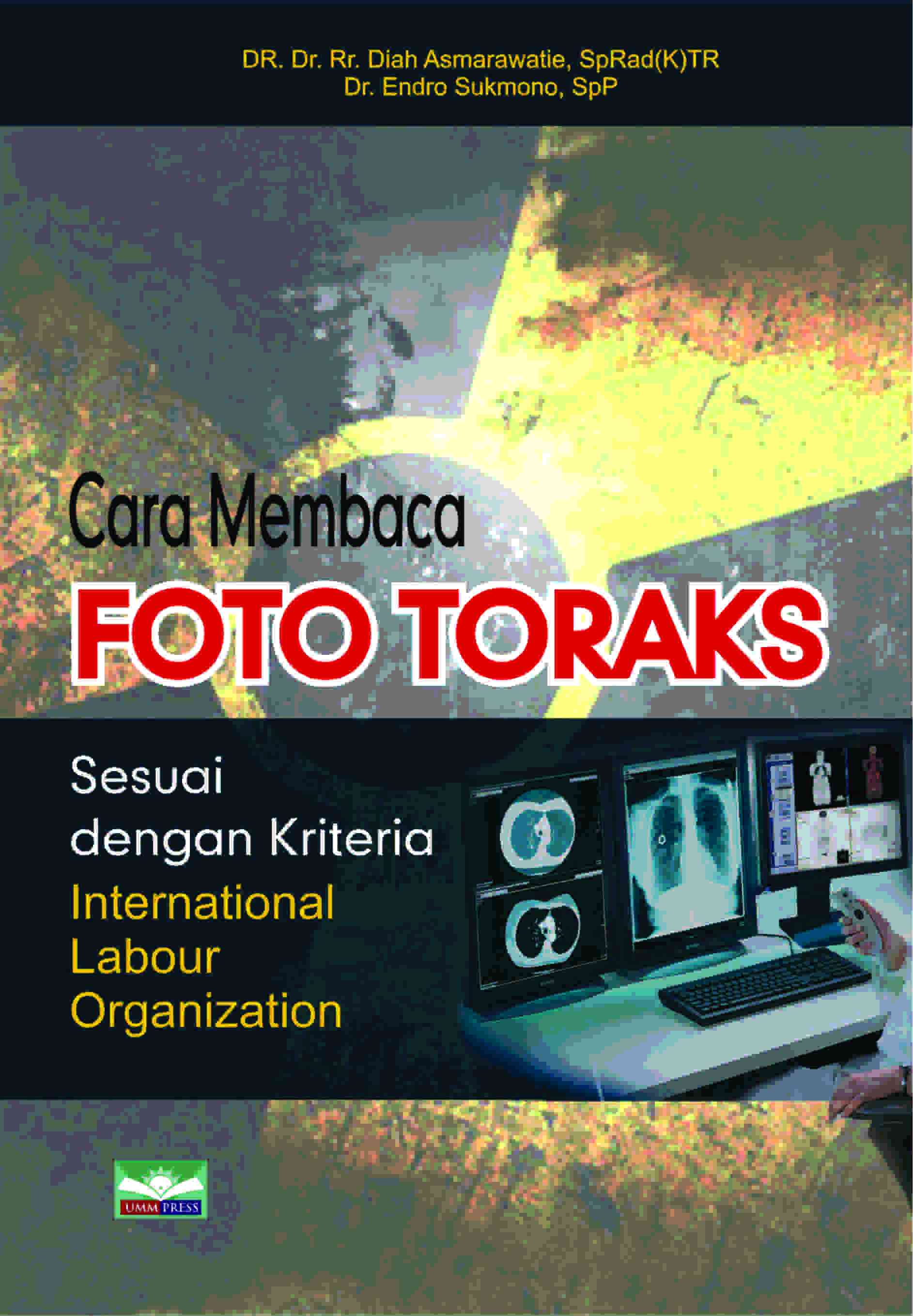 CARA MEMBACA FOTO TORAKS SESUAI DENGAN KRITERIA INTERNATIONAL LABOUR ORGANIZATION